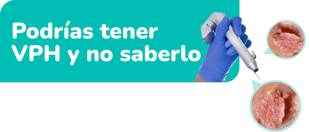 Podrias tener VPH y no saberlo